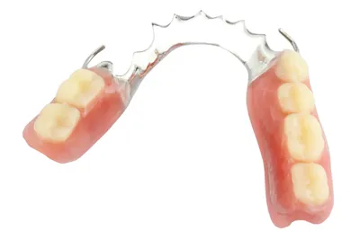 Съемное и частично-съемное протезирование в Ярославле - стоматология  Денталия