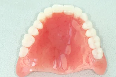 Съемное протезирование при полной потере зубов