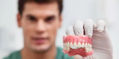 Съемное протезирование зубов в Уфе. Съемные протезы