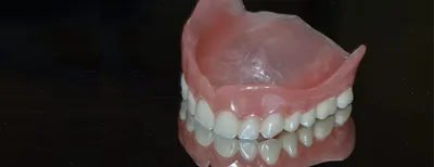 Съемные зубные протезы на верхнюю челюсть: какой материал выбрать?  Стоматология Dental Way в Москве и Московской области | Dental Way