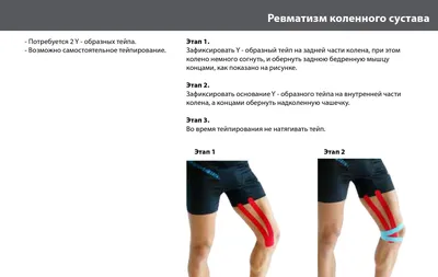 Ревматизм коленного сустава - Кинезиологический тейп компании ARES