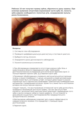 Задачи детская стоматология | Конспекты лекций Детская стоматология |  Docsity