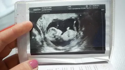 Первое УЗИ, 12 недель беременности+ фото- Lesya Life - YouTube