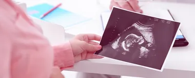 КАКИЕ Анализы СДАЮТ во время беременности?