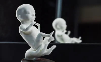 Стартап из Уфы превращает снимки УЗИ в 3D-модели эмбрионов :: Технологии и  медиа :: Журнал РБК