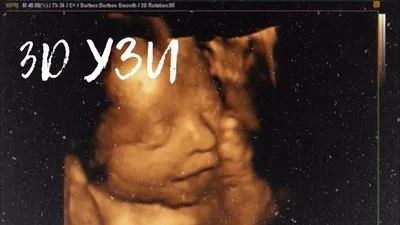 Идём на 3D УЗИ в Лодэ Беременность VLOG Я беременна третий раз Ждем дочку  Триждымама - YouTube