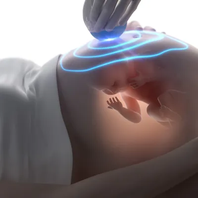 3D и 4D УЗИ при беременности сделать в СПб: ультразвуковое 3Д и 4Д  исследование плода, цены