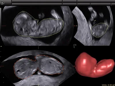 УЗИ беременности экспертного класса