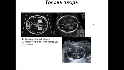 УЗИ для беременных, какие бывают и зачем нужны — блог медицинского центра  ОН Клиник