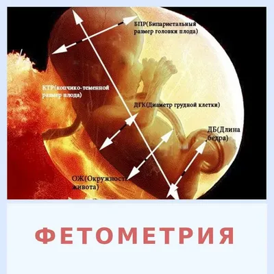 Беременность на 5 неделе: что происходит, почему болит и тянет, фото и  развитие плода