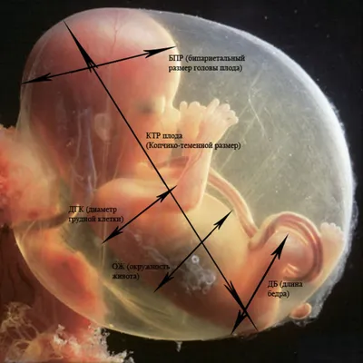 Расшифровка результатов УЗИ плода... - Медицинский Центр ЧА | Facebook