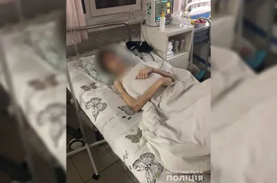 В Одессе будут лечить 16-летнего парня с крайним истощением: против отца  открыли дело — УСІ Online