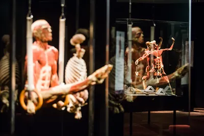 Что покажут на выставке человеческих тел Body Worlds - Киев Vgorode.ua