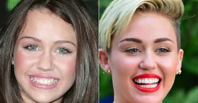 Голливудская улыбка: звезды с искусственными зубами (фотографии «до» и  «после») - Рамблер/женский