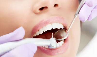 Показания к реставрации зубов и основные методы