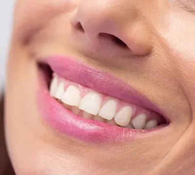 Красивая форма зубов: современные методы