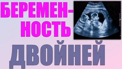 УЗИ ДВОЙНИ | На каком сроке можно определить наличие двойни - YouTube