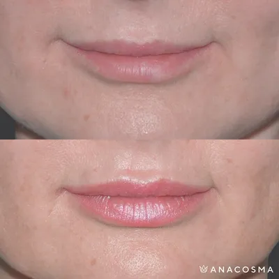 Какие бывают формы губ? – Блог ANACOSMA