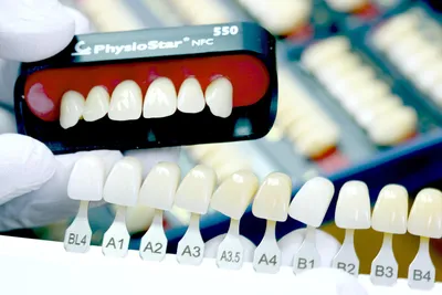 Какими бывают искусственные зубы? - Стоматология Москвы \"Королевская Улыбка\"