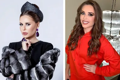 Юлия михалкова до и после пластики фото