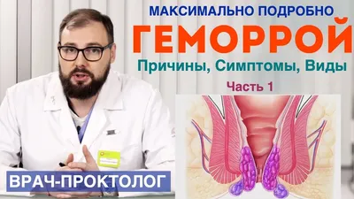Лазерное удаление геморроя - отзывы и цены на операцию в Оксфорд Медикал  Киев