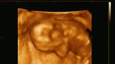 3D / 4D узи (15 недель беременности) - YouTube