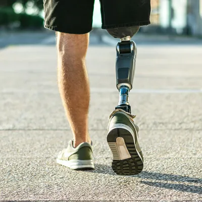 Обучение технике ходьбы на протезах бедра и голени | Как правильно научится  ходить на протезе ноги