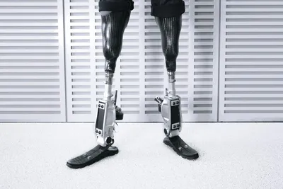 Бионический протез ноги - SMARTvider