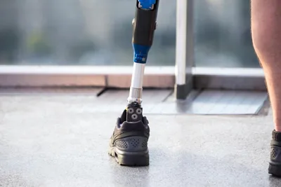 Бионическая нога с бесплатной документацией для копирования | Новости и  события мира телемедицины, mHealth, медицинских гаджетов и устройств