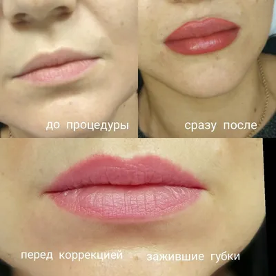 Зажившие губы после перманентного макияжа - 81 фото