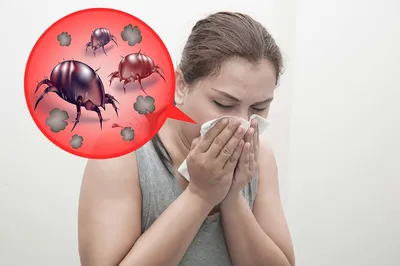 Пылевой клещ: уничтожение, как избавиться, удаление пылевых клещей —  аллергия, укус пылевого клеща - 15 марта 2022 - Sport24