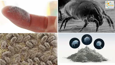 Аллергия на клещей домашней пыли может украсть ваш сон Чем опасны пылевые  клещи, аллергия