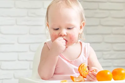 8 Продуктов, чаще всего вызвающих пищевую аллергию у детей. Что нужно знать  о пищевой аллергии. | БЕРЕМЕННОСТЬ | РОДЫ | МАТЕРИНСТВО | Дзен