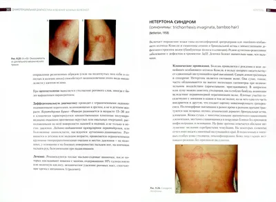 Иллюстрация 1 из 11 для Дифференциальная диагностика и лечение кожных  болезней - Потекаев, Акимов | Лабиринт - книги.