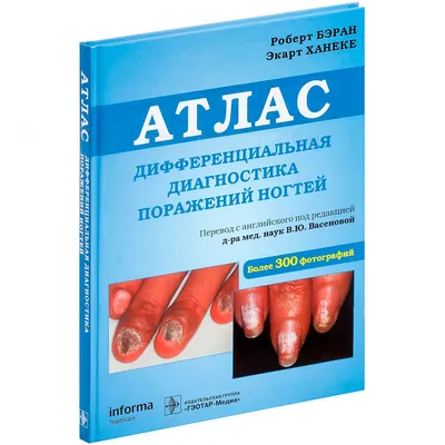 Дифференциальная диагностика поражений ногтей. Атлас ᐈ купить по низкой  цене в интернет-магазине VSALON24