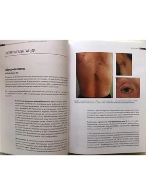 Дифференциальная диагностика и лечение кожных болезней ГЭОТАР-Медиа  25545297 купить в интернет-магазине Wildberries
