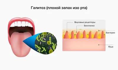 Причины запаха изо рта, и как добиться свежести - CreaLAB