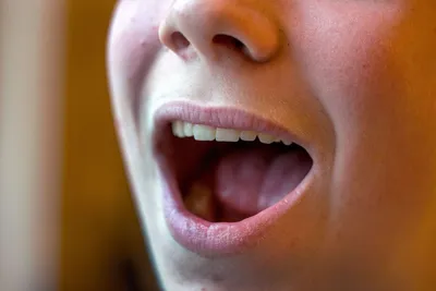Пробиотические бактерии помогают справиться с неприятным запахом изо рта