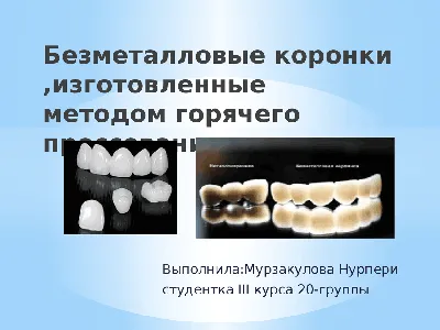 Керамические коронки E-max недорого в Москве - цены в стоматологии