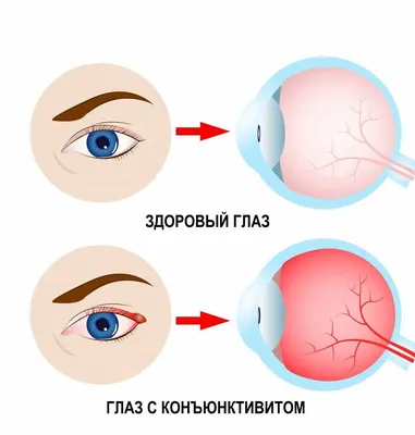 Глазные симптомы: какие заболевания могут ими сигнализировать?