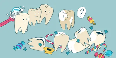Белые пятна на зубах: почему появляются и как убрать - Лайфхакер