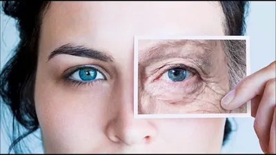 Как убрать морщины вокруг глаз: причины появления, домашние и  косметологические средства и процедуры от морщин