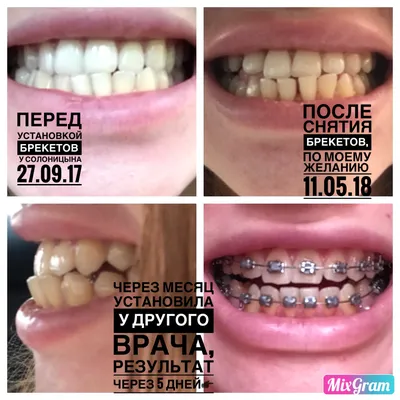 Идель, стоматологический кабинет в Кемерове — отзыв и оценка — Ирина