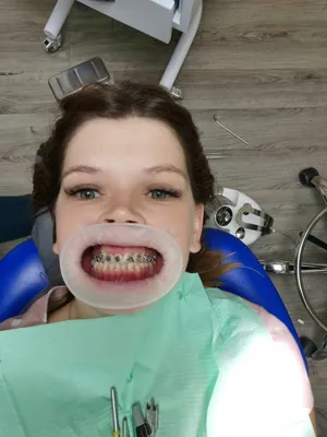 НовоДент, сеть стоматологических клиник в Новокузнецке — отзыв и оценка —  Оксана