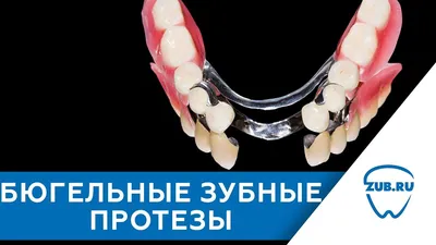 Бюгельные протезы зубов в Москве недорого - цены, отзывы на установку в  стоматологических клиниках Зуб.ру