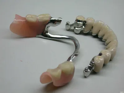 Бюгельные зубные протезы: цена. Съемное протезирование зубов на кламмерах и  аттачменах — РостДент