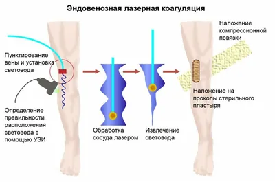 Фибромиома (фиброма) матки – необходимость лечения - новости и акции в  Омега-Киев