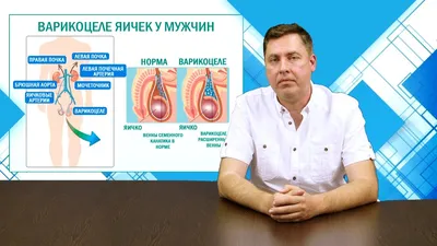 Лечение варикоцеле в Воронеже