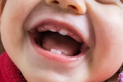 Помощь ребенку при прорезывании зубов – статьи детской стоматологической  клиники «Мартинка»