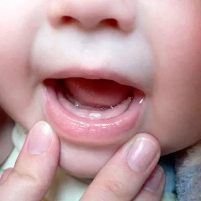 Могут ли резаться зубы в 3 месяца